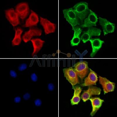IFT25 Antibody - DF12157 staining Hela cells by IF/ICC.