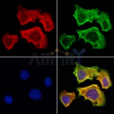 ISCU Antibody - DF12158 staining Hela cells by IF/ICC.