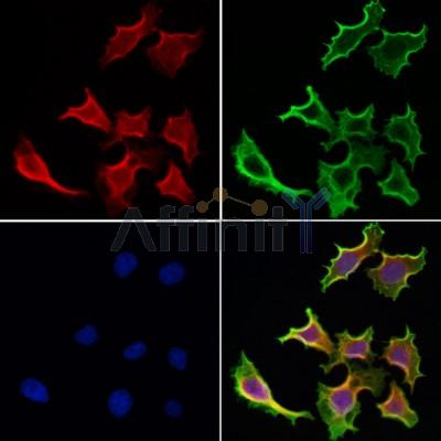SNX17 Antibody - DF12172 staining Hela cells by IF/ICC.