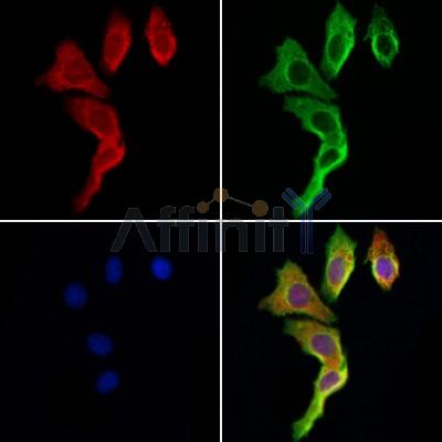 TRIM44 Antibody - DF12177 staining Hela cells by IF/ICC.