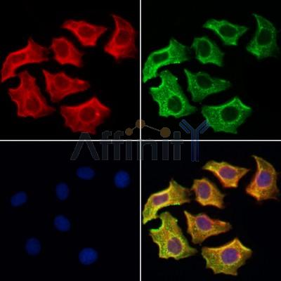 UQCRB Antibody - DF12179 staining Hela cells by IF/ICC.