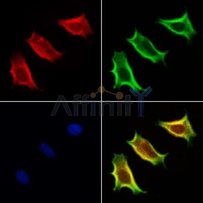 VPS33B Antibody - DF12181 staining Hela cells by IF/ICC.
