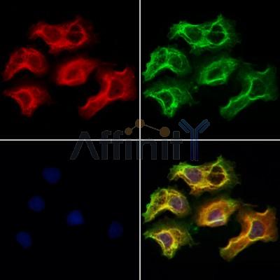 ZCCHC11 Antibody - DF12183 staining Hela cells by IF/ICC.