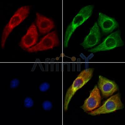 ERO1LB Antibody - DF12199 staining Hela cells by IF/ICC.