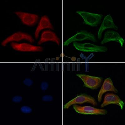 ETFB Antibody - DF12200 staining Hela cells by IF/ICC.