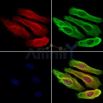 IPO4 Antibody - DF12207 staining Hela cells by IF/ICC.