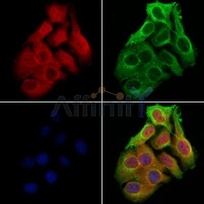 OTUD7B Antibody - DF12218 staining Hela cells by IF/ICC.