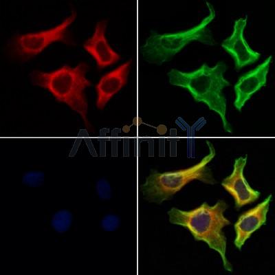P4HA1 Antibody - DF12219 staining Hela cells by IF/ICC.