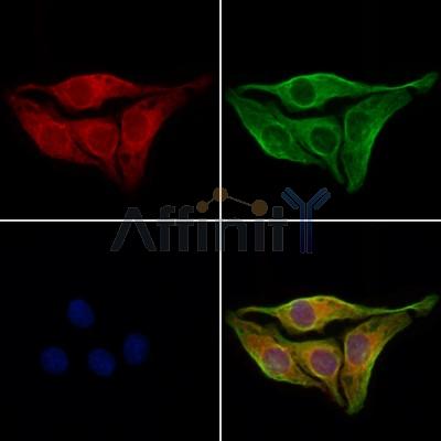PKLR Antibody - DF12221 staining Hela cells by IF/ICC.