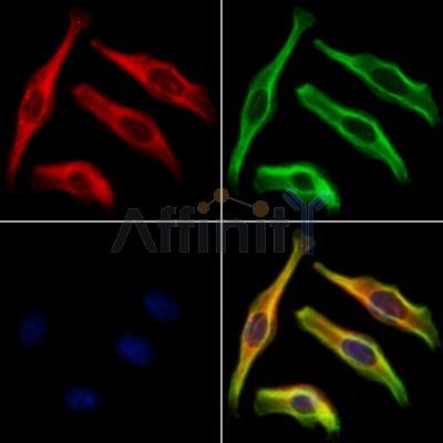 PRPH2 Antibody - DF12223 staining Hela cells by IF/ICC.