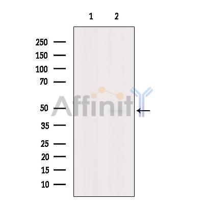 RSAD2 Antibody - Western blot analysis of extracts from 293t, using RSAD2 Antibody.