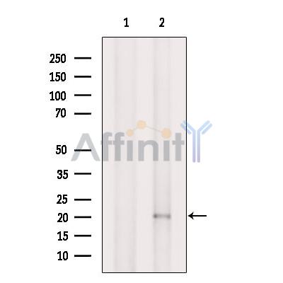 TIM22 Antibody - Western blot analysis of extracts from Mouse  lung, using TIM22 Antibody.