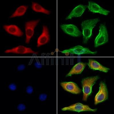UQCRFS1 Antibody - DF12240 staining Hela cells by IF/ICC.