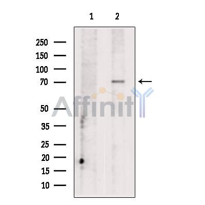 CCDC22 Antibody - Western blot analysis of extracts from Mouse  liver, using CCDC22 Antibody.