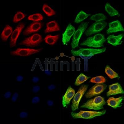 KIFC3 Antibody - DF12287 staining Hela cells by IF/ICC.
