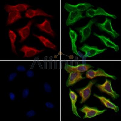 NDUFB11 Antibody - DF12300 staining Hela cells by IF/ICC.