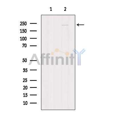 SPG11 Antibody - Western blot analysis of extracts from MCF7, using SPG11 Antibody.