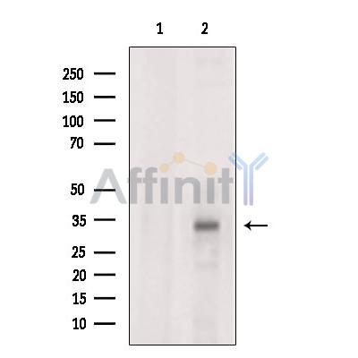 Stanniocalcin 2 Antibody - Western blot analysis of extracts from RAW264.