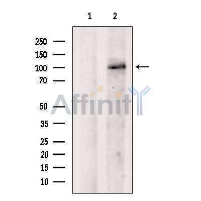DIS3 Antibody - Western blot analysis of extracts from MCF7, using DIS3 Antibody.