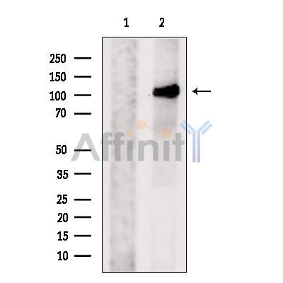 PACS2 Antibody - Western blot analysis of extracts from MCF7, using PACS2-Specific Antibody.