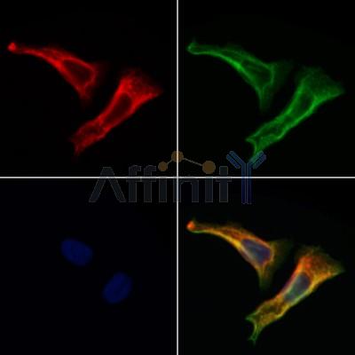 C19orf52 Antibody - DF12573 staining Hela cells by IF/ICC.