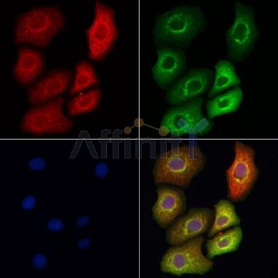 GSTT2B Antibody - DF12628 staining Hela cells by IF/ICC.