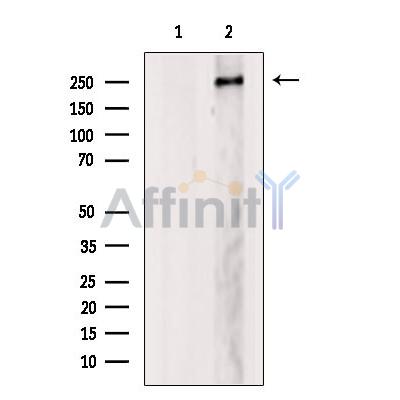 MED12 Antibody - Western blot analysis of extracts from Myeloma cells, using MED12 Antibody.