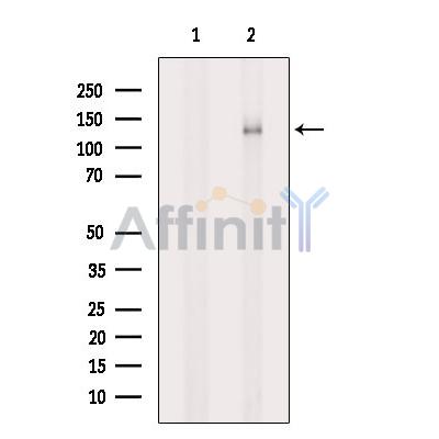 NKCC2 Antibody - Western blot analysis of extracts from 3T3, using NKCC2 Antibody.