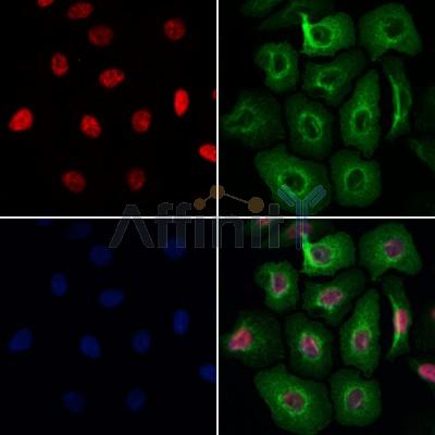 RNASEH2C Antibody - DF12725 staining Hela cells by IF/ICC.