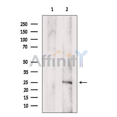 SPRR3 Antibody - Western blot analysis of extracts from Rat  muscle, using SPRR3 Antibody.