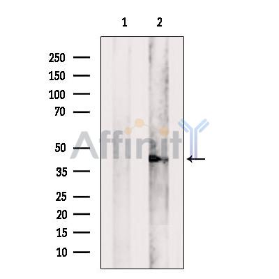 TACO1/CCDC44 Antibody - Western blot analysis of extracts from Rat  lung, using TACO1/CCDC44 Antibody.
