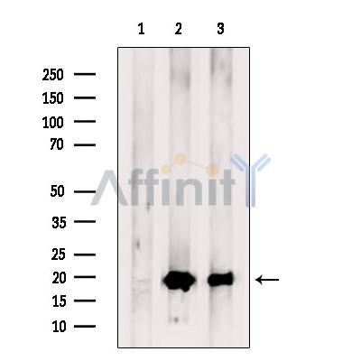TIMM17A Antibody - Western blot analysis of extracts from various samples, using TIMM17A Antibody.