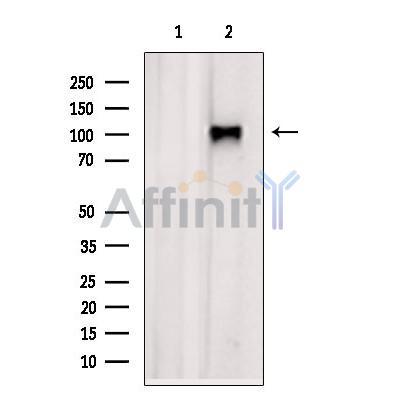 XPO6 Antibody - Western blot analysis of extracts from B16F10 cells, using XPO6 Antibody.