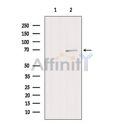 ZNF143 Antibody - Western blot analysis of extracts from Colo205, using ZNF143 Antibody.