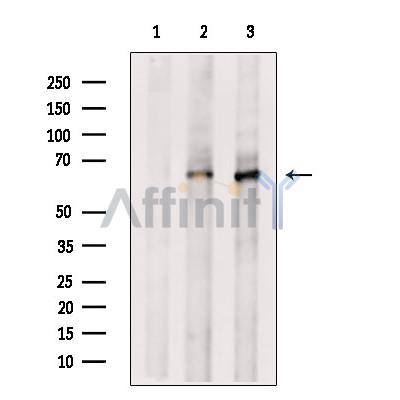 ARHGAP15 Antibody - Western blot analysis of extracts from various samples, using ARHGAP15 Antibody.
