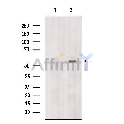 CCT6B Antibody - Western blot analysis of extracts from PC12, using CCT6B Antibody.