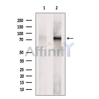 ECD Antibody - Western blot analysis of extracts from MCF7, using ECD Antibody.