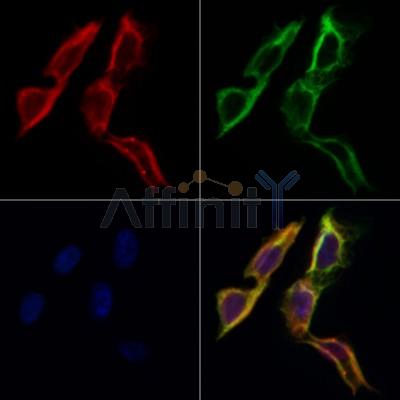 FAM134B Antibody - DF12997 staining Hela cells by IF/ICC.
