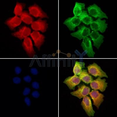 KRT36 Antibody - DF2552 staining Hela cells by IF/ICC.