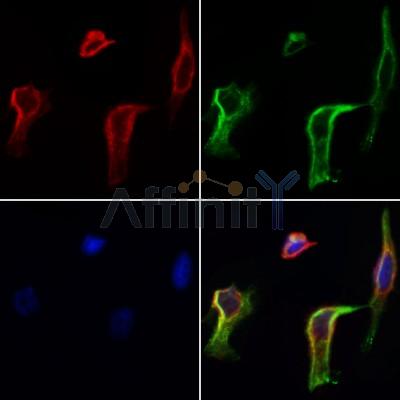 GPR20 Antibody - DF2730 staining Hela cells by IF/ICC.