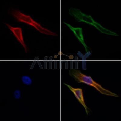 GPR63 Antibody - DF2757 staining Hela cells by IF/ICC.