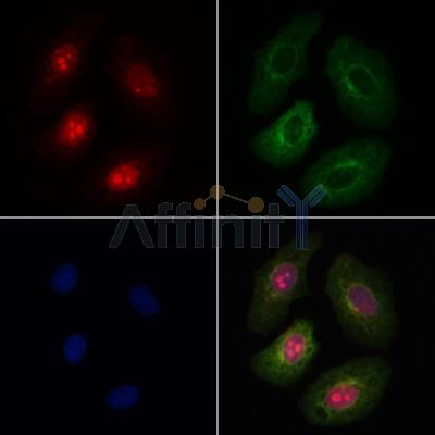 PHF1 Antibody - DF3020 staining Hela cells by IF/ICC.