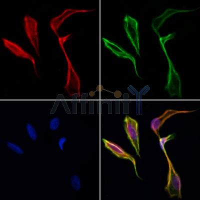 PFKFB1 Antibody - DF3098 staining Hela cells by IF/ICC.