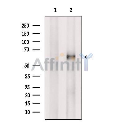 ACRBP Antibody - Western blot analysis of extracts from Rat  brain, using ACRBP Antibody.