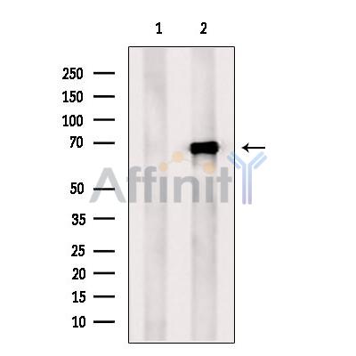 IRAK1 Antibody - Western blot analysis of extracts from Rat  brain, using IRAK1 Antibody.