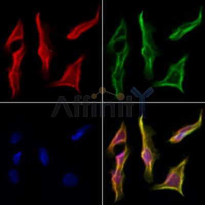CDCA3 Antibody - DF3544 staining Hela cells by IF/ICC.