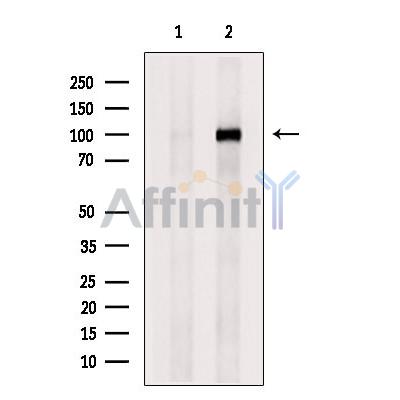 PMS2 Antibody - Western blot analysis of extracts from Myeloma cells, using PMS2 Antibody.