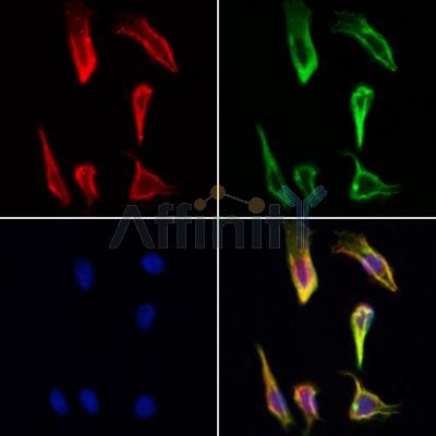 CEP70 Antibody - DF3920 staining Hela cells by IF/ICC.