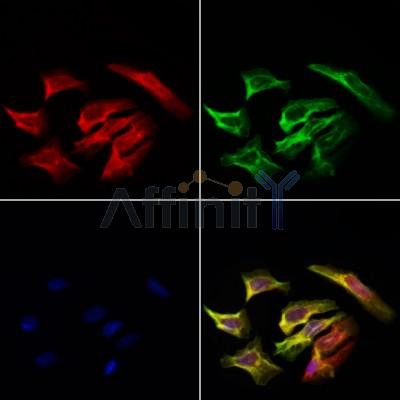 EIF3K Antibody - DF4052 staining Hela cells by IF/ICC.