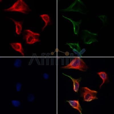 GSDMC Antibody - DF4157 staining Hela cells by IF/ICC(Green).